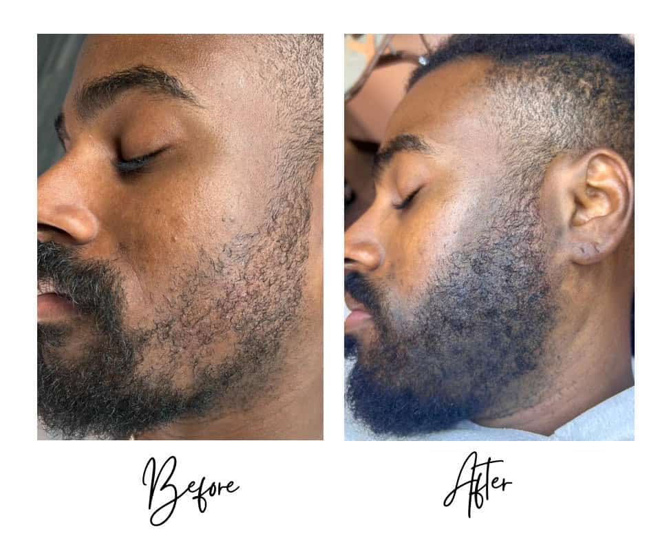 BA2