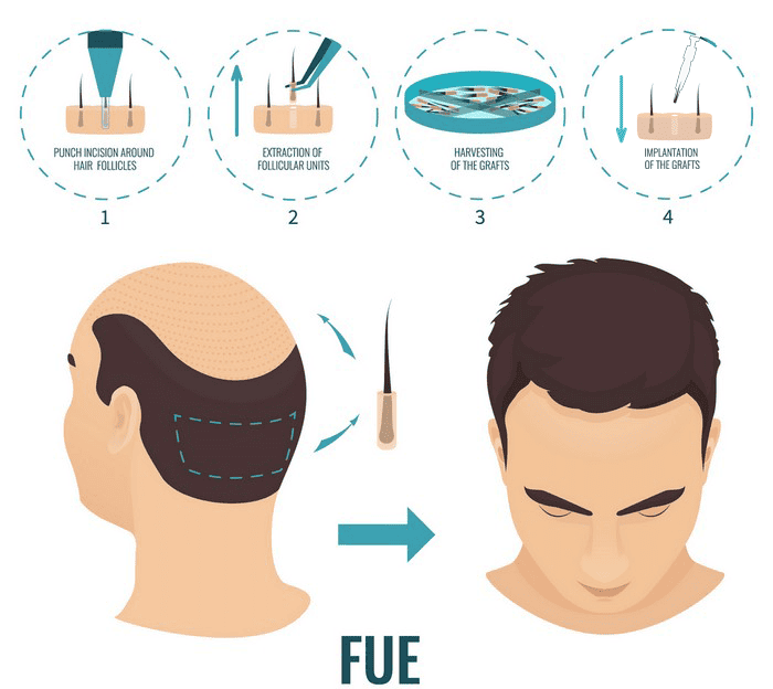 fuehair