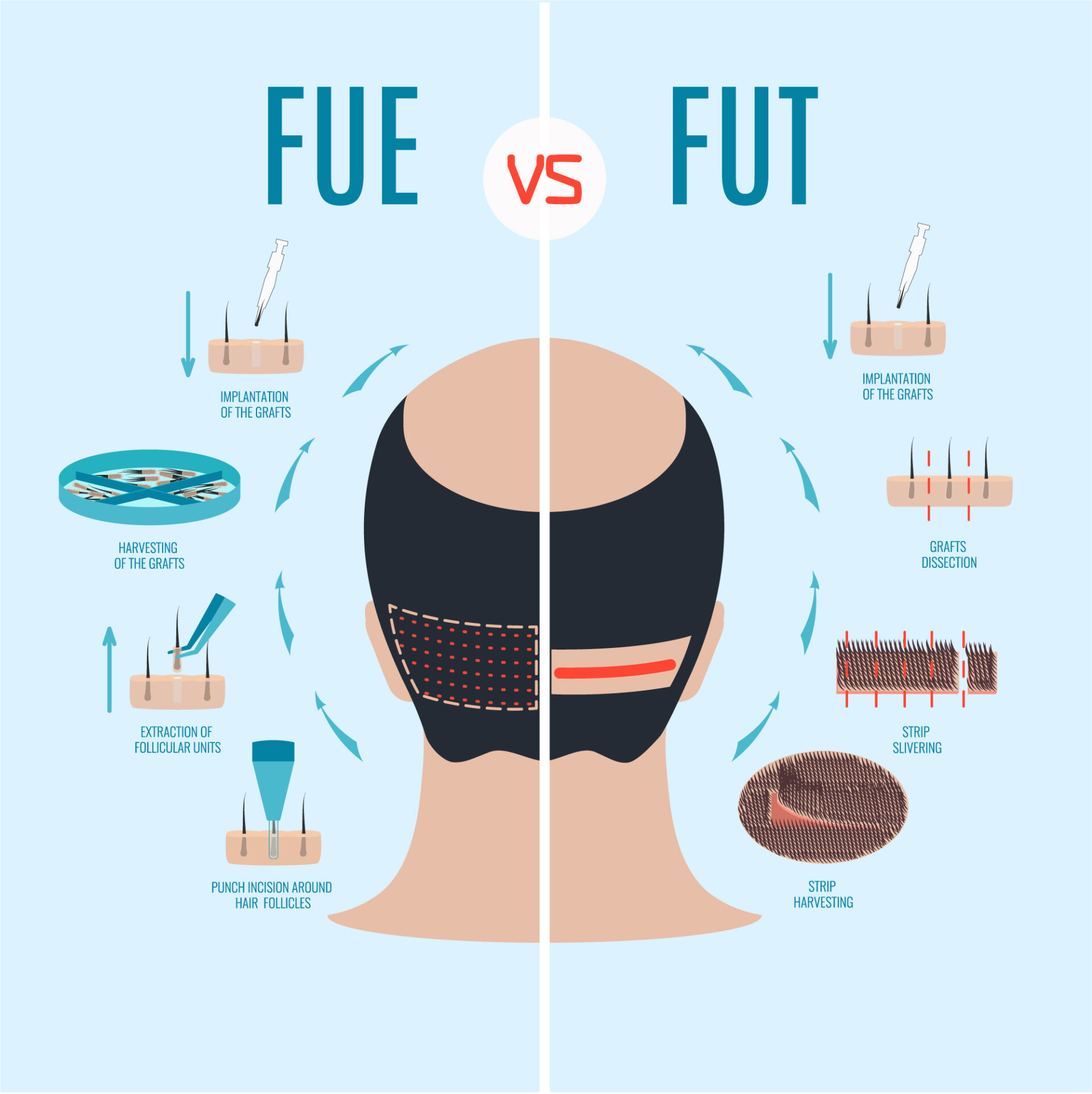 fuevsfut