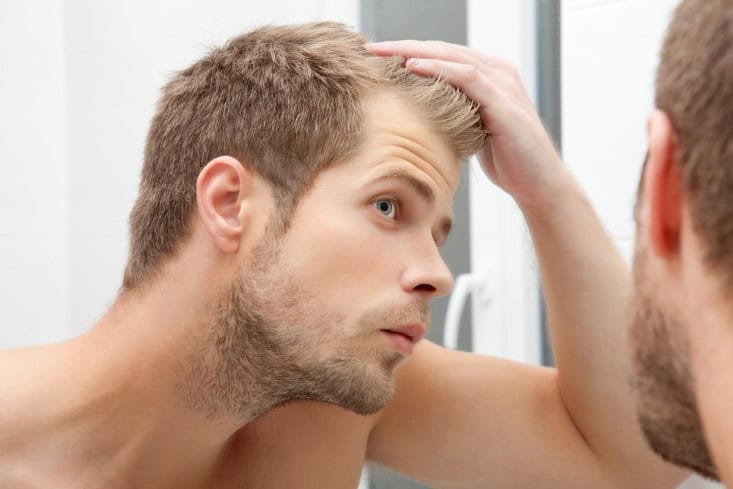 hair-loss