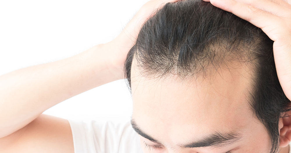 micropigmentation